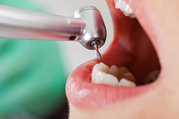 Best Emergency Tooth Extraction in Geronimo, OK